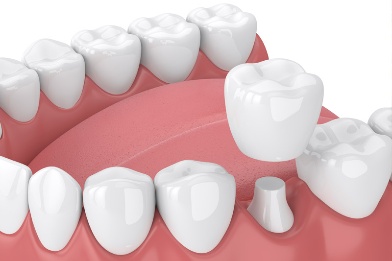 Dental Treatments in Normal